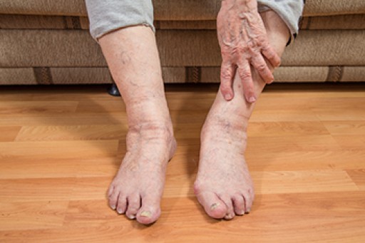 Taking Care of Elderly Feet