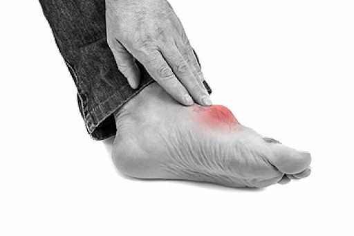 Everything You Need to Know About Gout