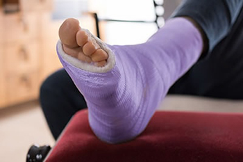 foot and ankle fractures treatment in the Ventura County, CA: Thousand Oaks (Simi Valley, Camarillo, Moorpark, Oak Park) and Los Angeles County, CA: Calabasas, Cornell, Agoura Hills areas